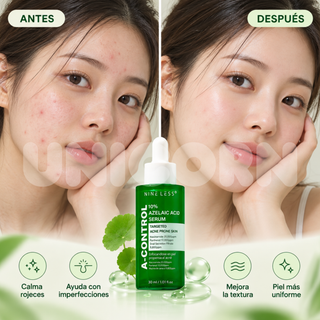 Nineless Sérum A-Control 10% Azelaic Acid Serum Antiacné con Ácido Azelaico 30 ml