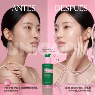 Nineless Sérum A-Control 10% Azelaic Acid Serum Antiacné con Ácido Azelaico 30 ml